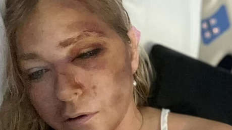 Surgen detalles del accidente de tráfico de una víctima de Epstein que dijo que le quedaban «días» de vida